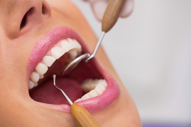 ¿Cómo han cambiado nuestras costumbres en la salud dental?